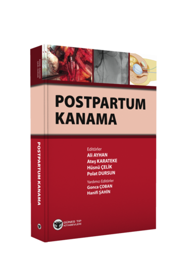 Postpartum Kanama