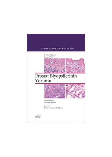 Prostat Biyopsilerinin Yorumu Biyopsi Yorumları Serisi