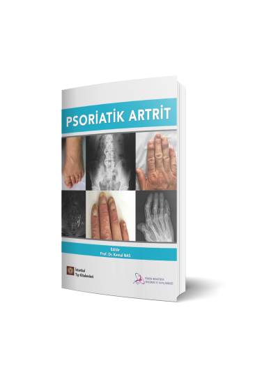 Psoriatik Artrit