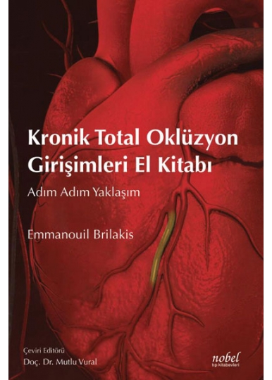 Kronik Total Oklüzyon Girişimleri El Kitabı: Adım Adım Yaklaşım
