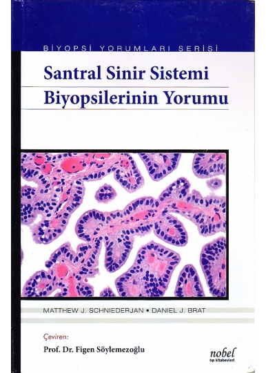 Santral Sinir Sistemi Biyopsilerinin Yorumu Biyopsi Yorumları Serisi