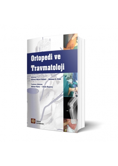 Ortopedi Ve Travmatoloji
