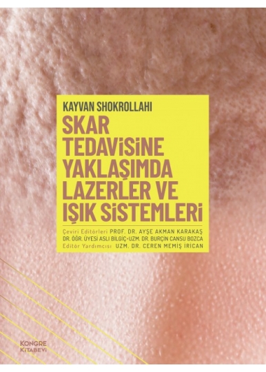 Skar Tedavisine Yaklaşımda Lazerler ve Işık Sistemleri