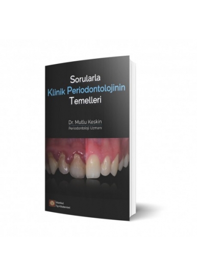 Sorularla Klinik Periodontolojinin Temelleri