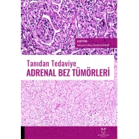 Tanıdan Tedaviye Adrenal Bez Tümörleri