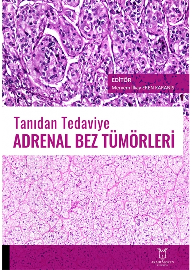 Tanıdan Tedaviye Adrenal Bez Tümörleri