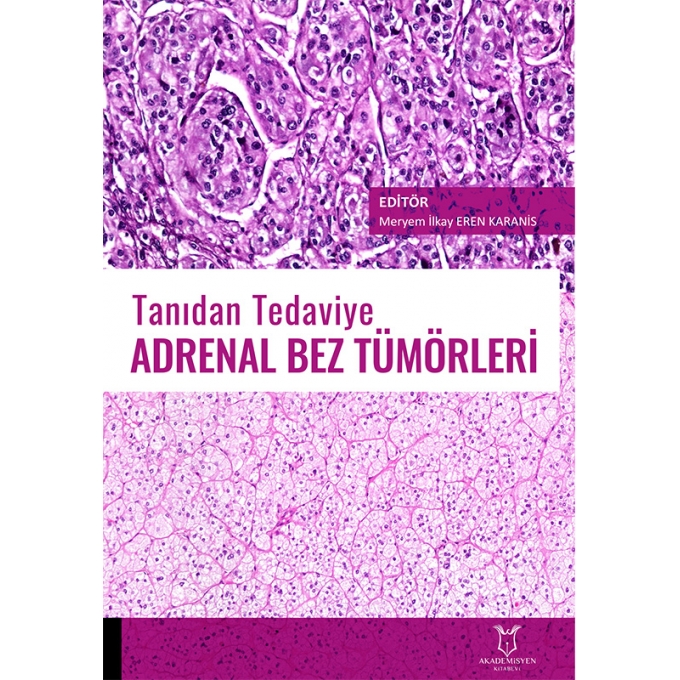 Tanıdan Tedaviye Adrenal Bez Tümörleri