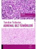 Tanıdan Tedaviye Adrenal Bez Tümörleri