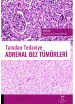 Tanıdan Tedaviye Adrenal Bez Tümörleri