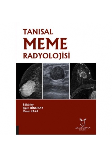 Tanısal Meme Radyolojisi