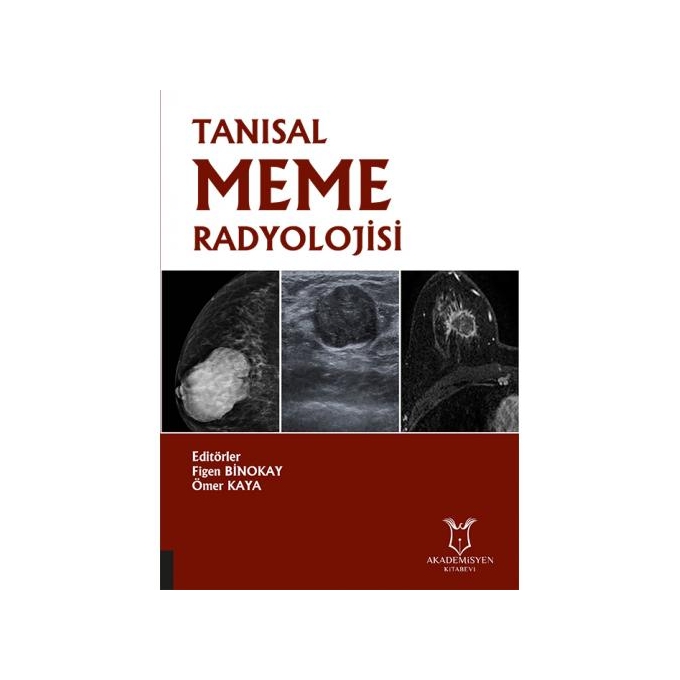 Tanısal Meme Radyolojisi