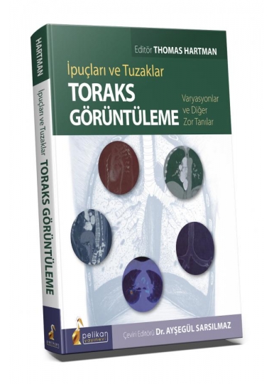 İpuçları ve Tuzaklar Toraks Görüntüleme