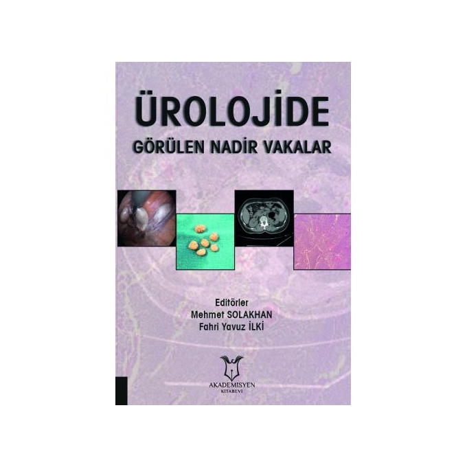 Ürolojide Görülen Nadir Vakalar