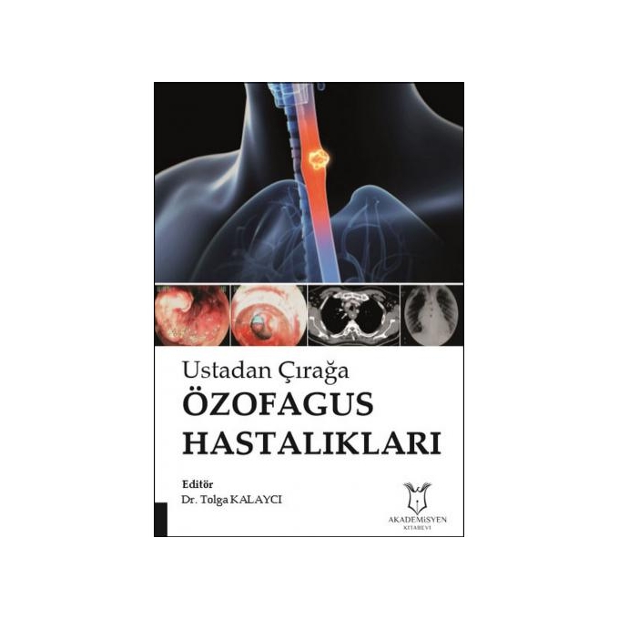Ustadan Çırağa Özofagus Hastalıkları