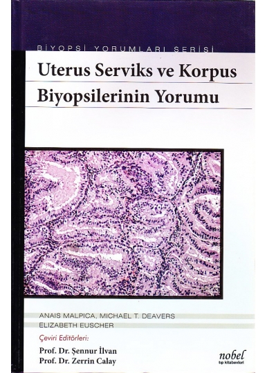 Uterus Serviks ve Korpus Biyopsilerinin Yorumu Biyopsi Yorumları Serisi