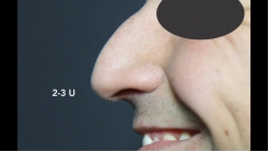Sito Botulinum Toksin Video 3.10