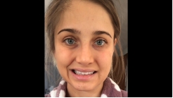 Sito Botulinum Toksin Video 3.14