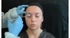 Sito Botulinum Toksin Video 3.8