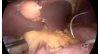 Video 13-4