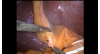 Video 13-9