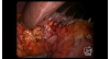 Video 13-10