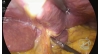 Video 13-12