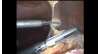 Video 13-13