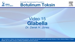 Video 15: Glabella
