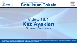 Video 18.1: Kaz Ayakları