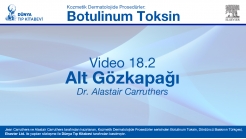 Video 18-2: Alt Gözkapağı