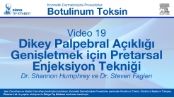 Video 19: Dikey Palpebral Açıklığı Genişletmek için Pretarsal Enjeksiyon Tekniği