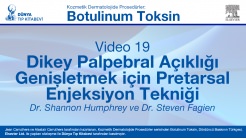 Video 19: Dikey Palpebral Açıklığı Genişletmek için Pretarsal Enjeksiyon Tekniği