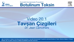 Video 20-1: Tavşan Çizgileri