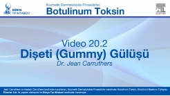 Video 20-2: Dişeti (Gummy) Gülüşü