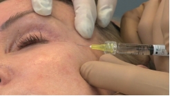 Lat-can Tünel Tekniği