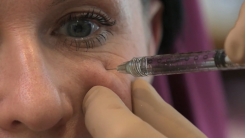 IOH Lateral Uygulama