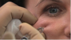 Bukko Maksiller Ligaman