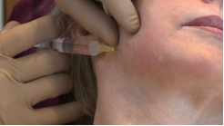 Çene Hattı ve Yanak Alt Kısmı HAC