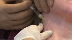 Derin Boyun Çizgileri