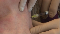 Boyun Elastozu Nokta Tekniği