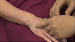 Eller Point Tekniği