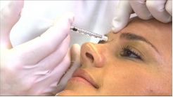 Yönlendirilmiş Enjeksiyon Teknikleri