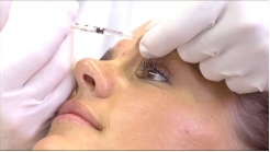 Yüzün Üst Üçte Birlik Kısmı-Olgu 1