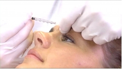 Yüzün Üst Üçte Birlik Kısmı-Olgu 2