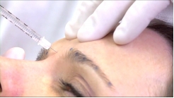 Yüzün Üst Üçte Birlik Kısmı-Olgu 3