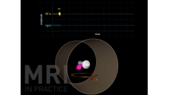 Animation 3.1 (The 180° RF Pulse)