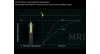 Animation 3.3 Inversion Recovery