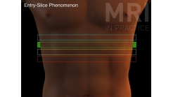 Animation 8.2 (Entry-slice Phenomenon)