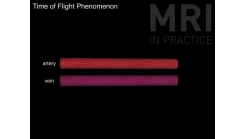 Animation 8.3 Time of Flight