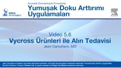 Video 5.6: Vycross Ürünleri ile Alın Tedavisi